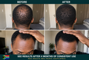 FEG Hair Growth Spray | Fuller, Thicker & Healthier Hair