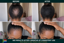 FEG Hair Growth Spray | Fuller, Thicker & Healthier Hair