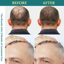 FEG Hair Growth Spray | Fuller, Thicker & Healthier Hair
